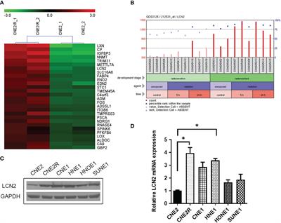 LCN2 Is a Potential Biomarker for Radioresistance and Recurrence in Nasopharyngeal Carcinoma